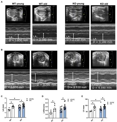 B-arrestin-2 Signaling Is Important to Preserve Cardiac Function During Aging